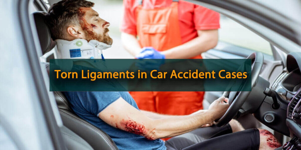 Car Accident